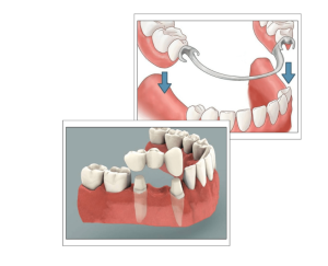 Edremit diş protezi - Dent Edremit