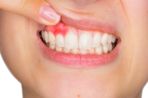periodontoloji