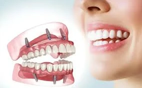 dental protes